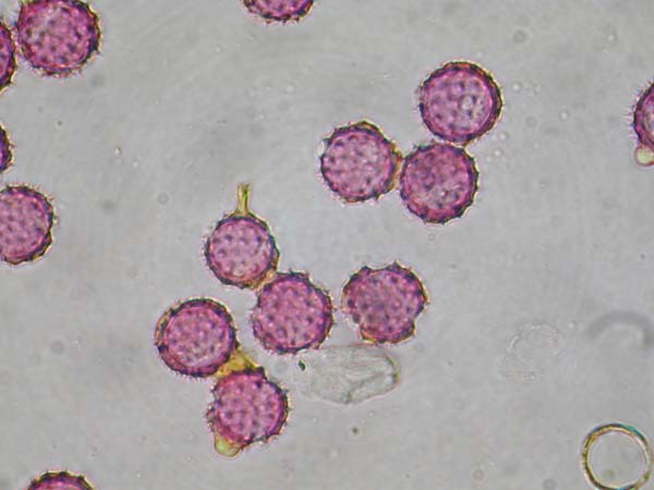 Acroclinum roseum1