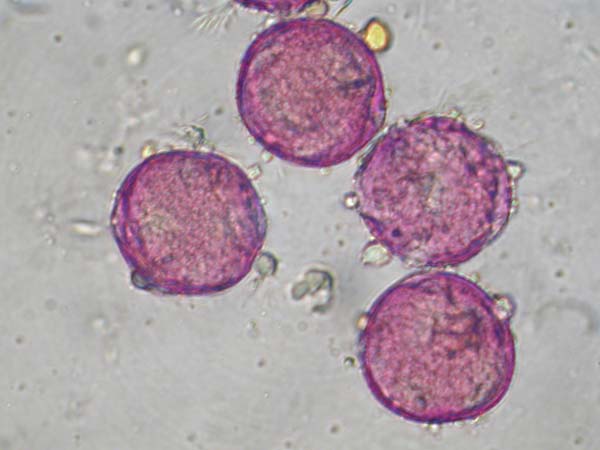 Astrophytum myriostigma1