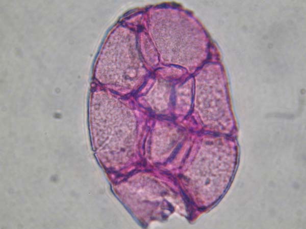 Calliandria haematocephala