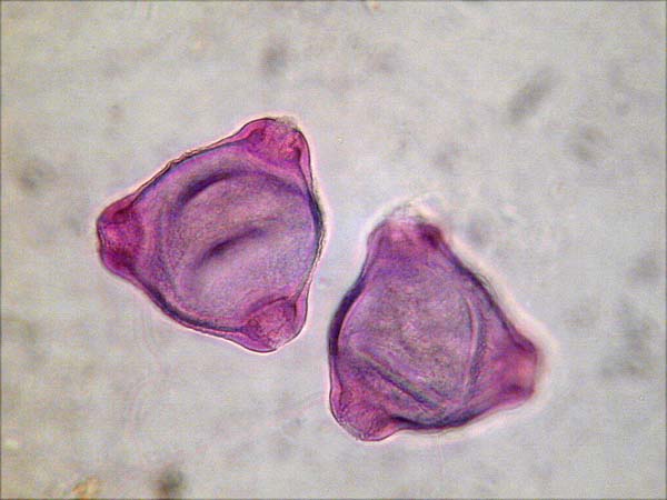 Chamaenerion angustifolium