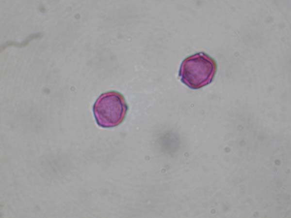 Clusia palmicida1