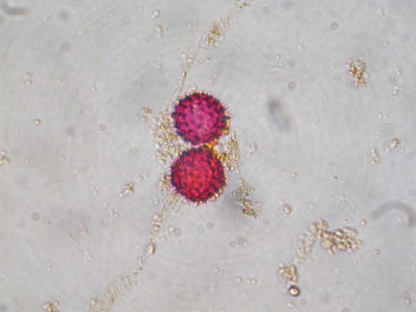 Coreopsis tinctoria1