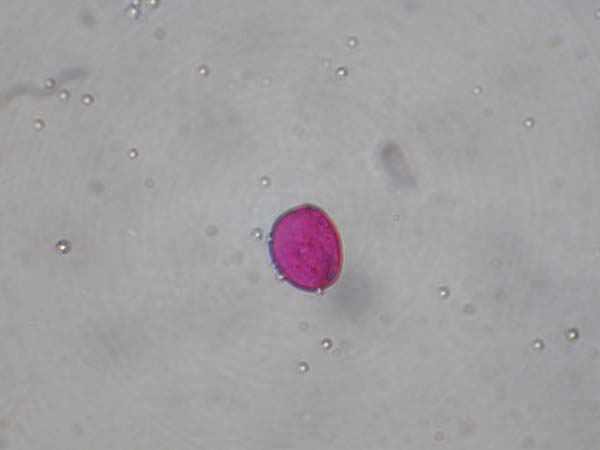 Cytisus sessifolius1