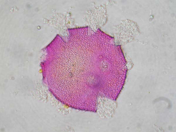 Luffa cylindrica1