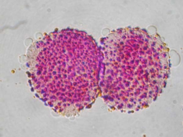 Meconopsis x sheldonii1