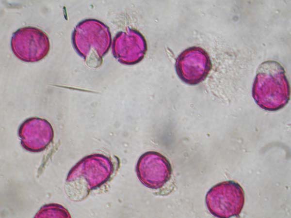 Phytolacca coriacea
