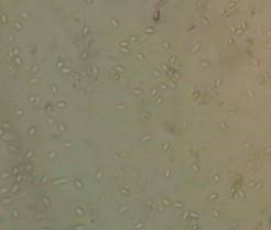 nosema spores at x400